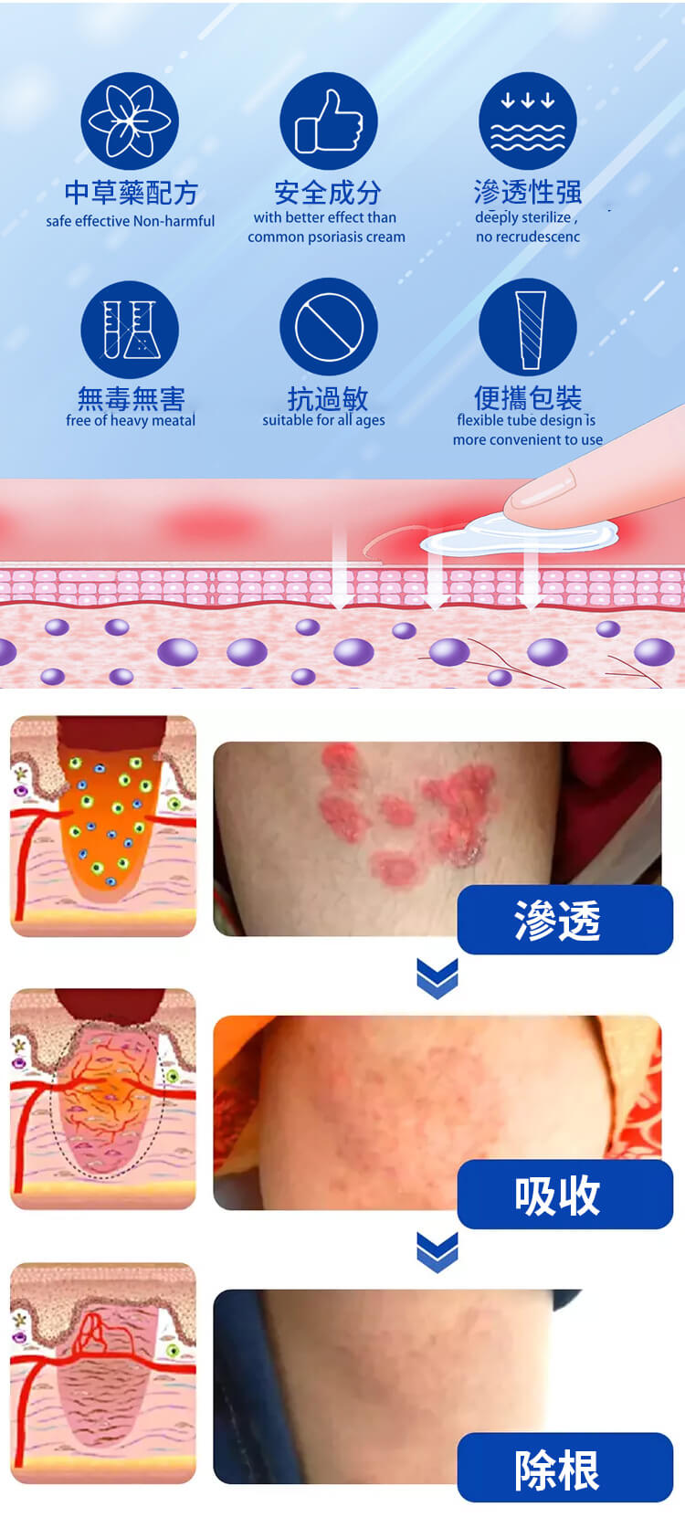 頑選靈草本乳膏