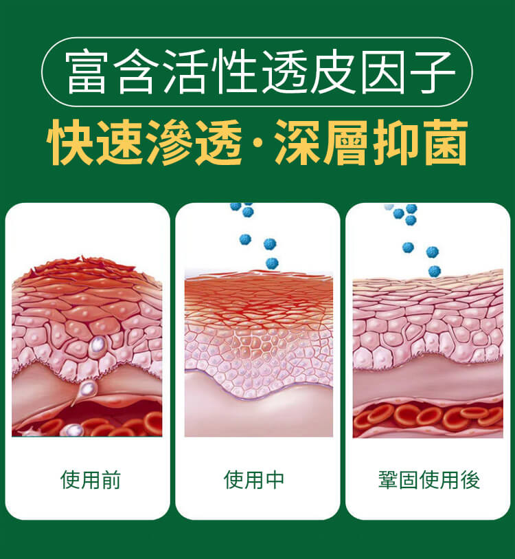 頑選靈草本乳膏